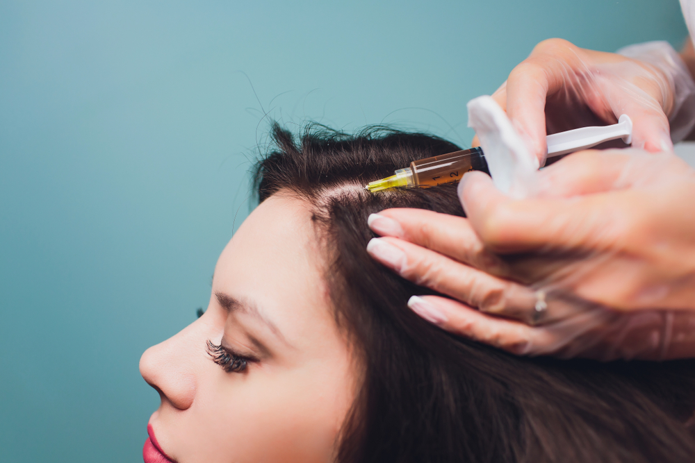 Specialist administers EZ Gel PRF for hair growth